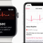 ECG Apple Watch