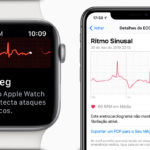 ECG Apple Watch