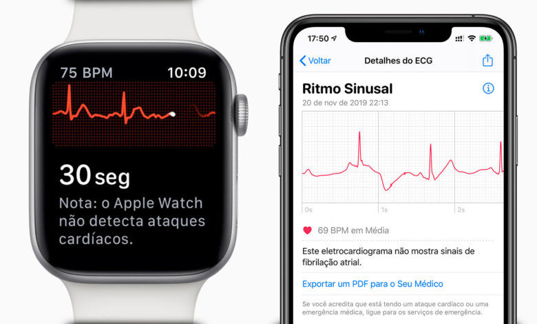 ECG Apple Watch