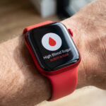Apple Watch blood sugar