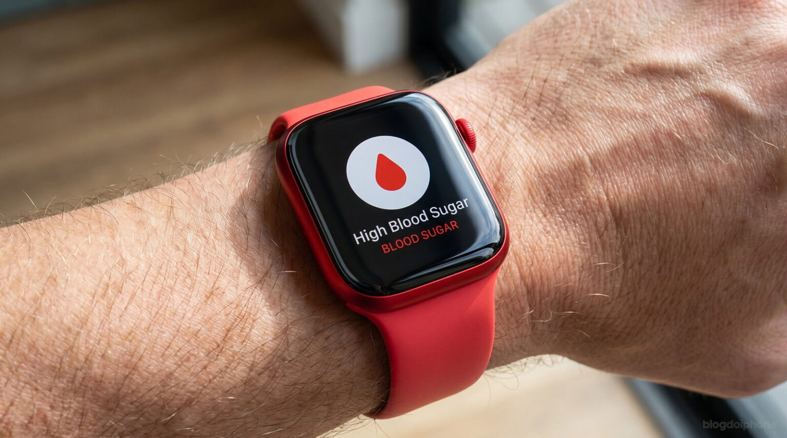 Apple Watch blood sugar